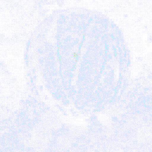 Forensic suspicion heatmap
